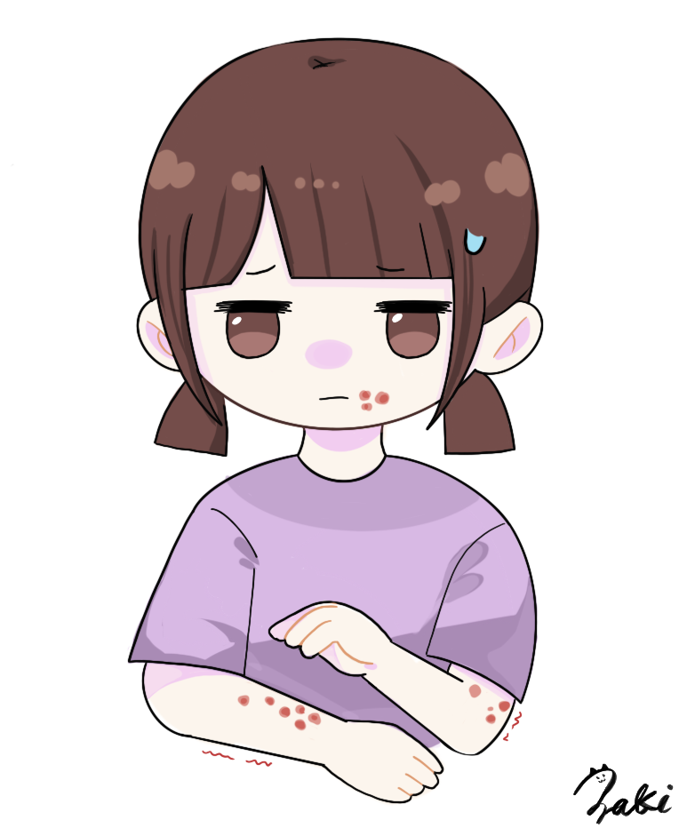 とびひ 病院 イラスト 子ども