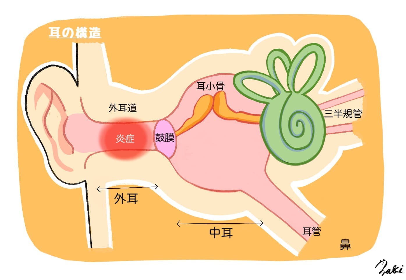 外耳炎